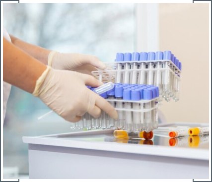 DNA Cryopreservation-img DNA Cryopreservation