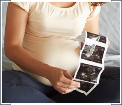 Dating Scan-img Dating Scan